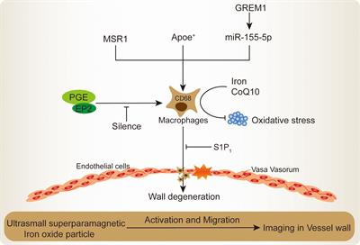 Current understanding of macrophages in intracranial aneurysm: relevant etiological manifestations, signaling modulation and therapeutic strategies